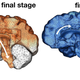 The final stages of amyloid beta (orange) and tau (blue) progression in someone with Alzheimer’s.